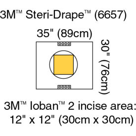 3M™ Steri-Drape Pouch with Ioban 2 Incise Film 6657 35