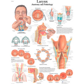 3B® Anatomical Chart - Larynx Laminated 12-4612L