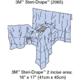 3M™ Steri-Drape Abdominal-Perineal Drapes 2065 77